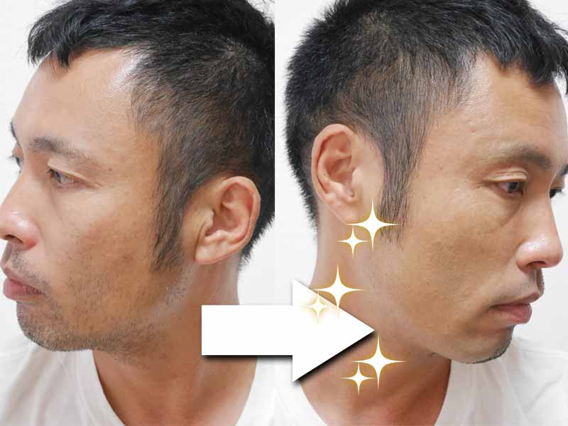 ガレイドのカミソリを使った結果